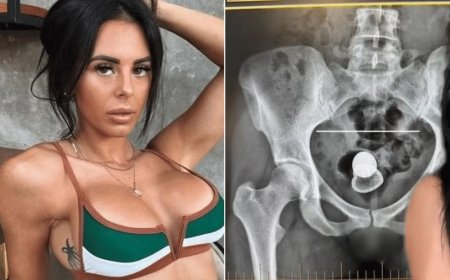 Atriz de Conteúdo Adulto revala que ficou com plug anal preso no corpo