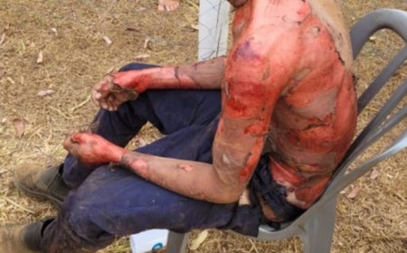 Suspeito de roubar mercado tem corpo queimado por dono do comércio