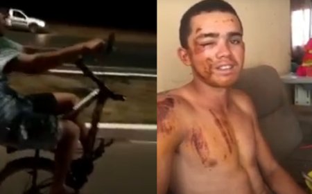 Jovem sofre acidente ao empinar bicicleta sem roda dianteira e vídeo viraliza nas redes