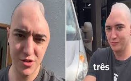 Influenciador viraliza ao explicar como parte do crânio foi parar no abdômen