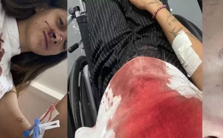 Jovem é agredida brutalmente após esbarrar em homem