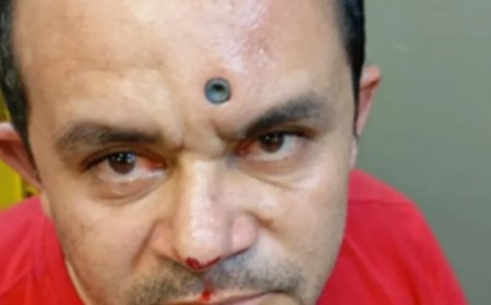 Homem sobrevive após ser baleado na testa