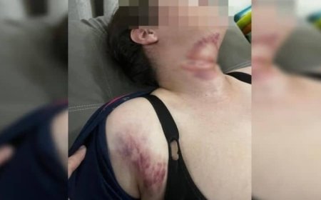 Fio solto corta pescoço e derruba mulher de garupa de moto; Veja as fotos