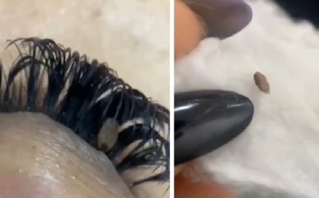 Designer encontra carrapato preso na pálpebra de cliente durante manutenção de cílios e repercute nas redes sociais