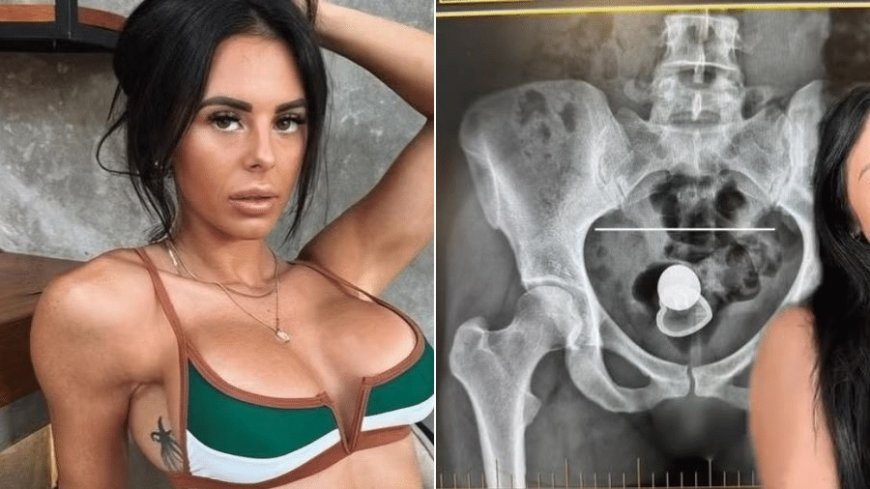 Atriz de Conteúdo Adulto revala que ficou com plug anal preso no corpo