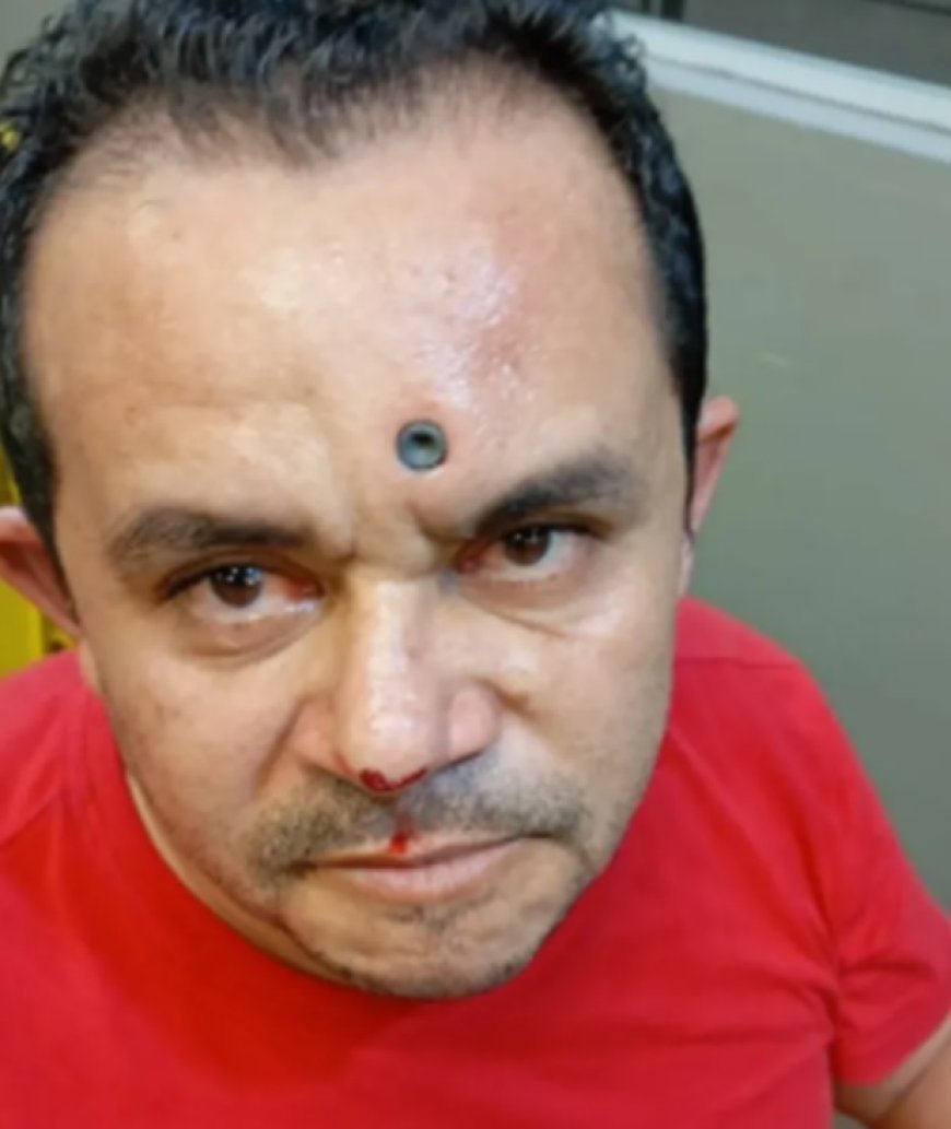 Homem sobrevive após ser baleado na testa