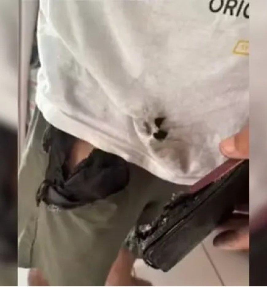 Celular pega fogo e explode em bolso de homem