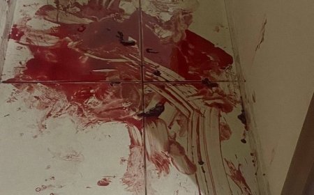 Mulher é socorrida após ter mandíbula e ao menos 4 dentes quebrados