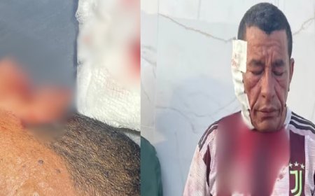 Pescador tem orelha arrancada durante briga política