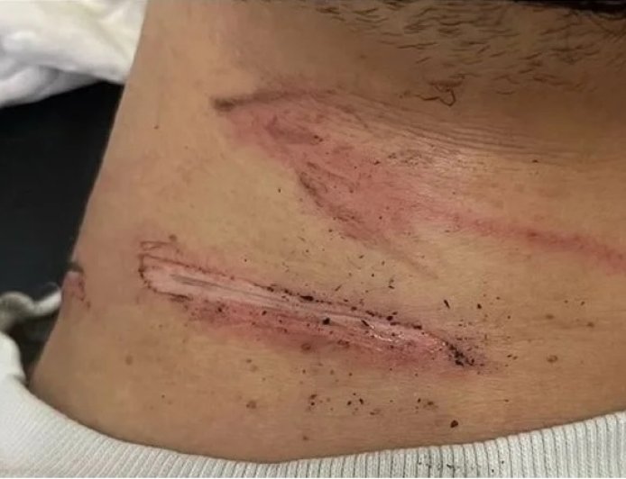 Motociclista e passageira ficam feridos após se enroscarem com fios em rua e caírem de moto