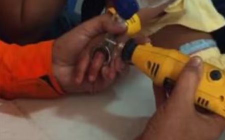 Criança prende peça de aço no dedo e bombeiros levam uma hora para remover