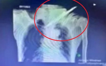 Idoso sobreviveu a tentativa de homicídio com faca cravada no pescoço