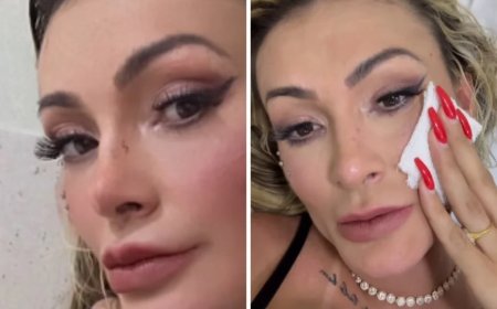 Andressa Urach se envolve em briga e vai parar no hospital; VEJA