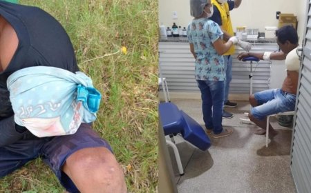 Pescador sofre ataque de Jacaré e perde braço