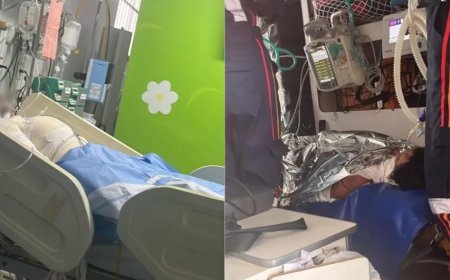 Adolescente tem o corpo queimado enquanto dormia após fugir para encontrar namorado; sogra é a principal suspeita