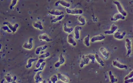Testes confirmam que ameba rara causou morte de criança no Ceará