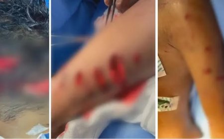 Menino de 7 anos sofre ataque de cachorros e fica gravemente ferido