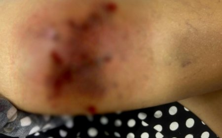 Ataque de pitbull deixa mulher ferida e resulta na prisão de três pessoas em Itaberaí, GO