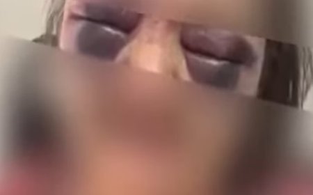 IMAGENS FORTES: Cuidadora é presa suspeita de torturar idosa com cabo de vassoura