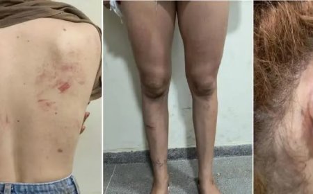 Polícia investiga homem, namorada e sogra por agressão contra jovem na Bahia; vítima era amiga do suspeito