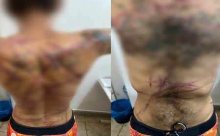 IMAGENS FORTES: PCGO prende dupla em flagrante por torturar vítima após suposto furto de ferramentas