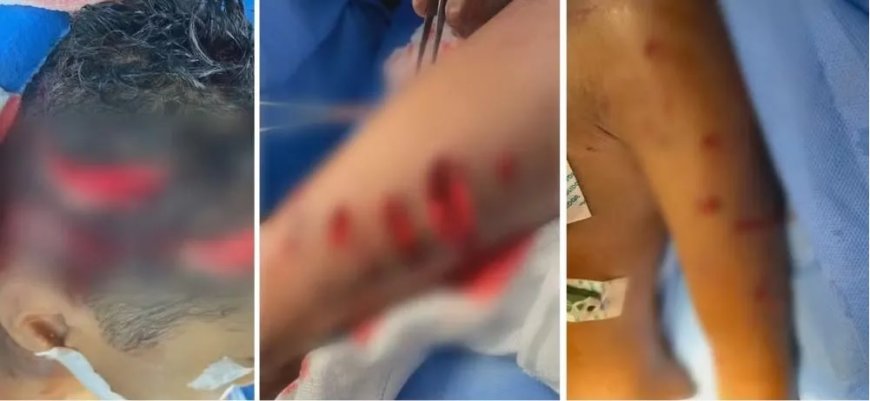 Menino de 7 anos sofre ataque de cachorros e fica gravemente ferido
