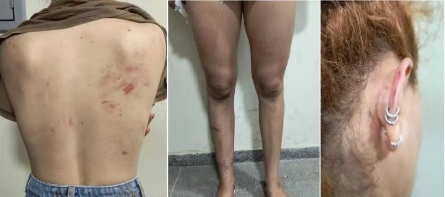 Polícia investiga homem, namorada e sogra por agressão contra jovem na Bahia; vítima era amiga do suspeito