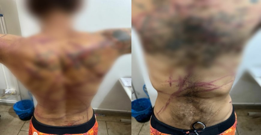 IMAGENS FORTES: PCGO prende dupla em flagrante por torturar vítima após suposto furto de ferramentas