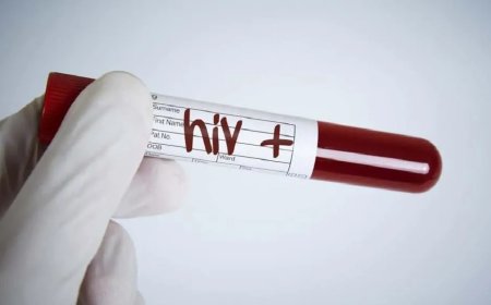 Febre, cansaço e manchas na pele? Conheça os sinais iniciais do HIV