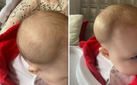 Mãe descobre fratura no crânio da filha ao buscá-la em creche