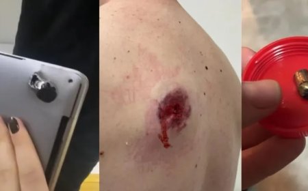 Baleado durante assalto, homem sobrevive graças a notebook na mochila