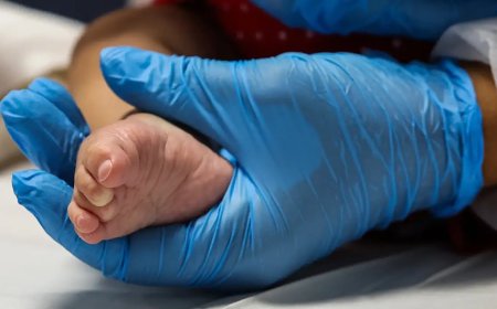 SUS vai ofertar remédio de alto custo para Atrofia Muscular Espinhal