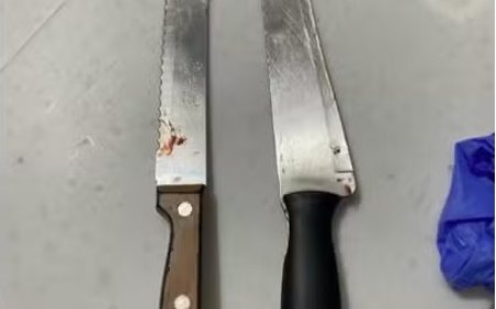 Mulher é presa após esfaquear e cortar cabelo de irmã gêmea em SC