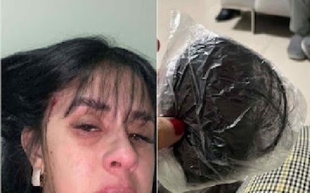 Cantora sertaneja é agredida e tem cabelo cortado logo após sofrer ameaças