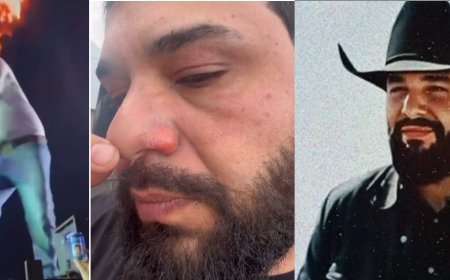 Cantor Leonardo, da dupla Léo & Raphael, sofre queimaduras no rosto durante show