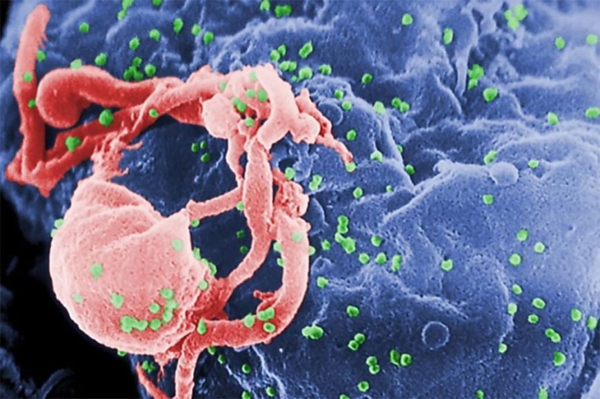Transmissão pela comida? Infectologista rebate mitos sobre o HIV