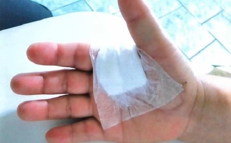 Médico é condenado a indenizar paciente em R$ 10 mil após operar dedo errado em Caçapava