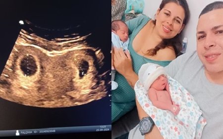 Com 2 úteros, mãe diz que gêmeos “tinham quarto separado na barriga”