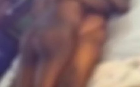 Casal viraliza ao ficar “colado” após confundir supercola com lubrificante íntimo; vídeo gera espanto e risos nas redes