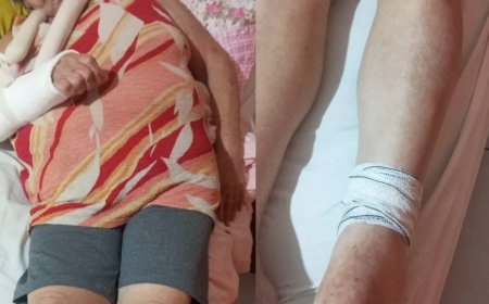 Idosa de 77 anos é agredida com cabo de vassoura em condomínio no RJ