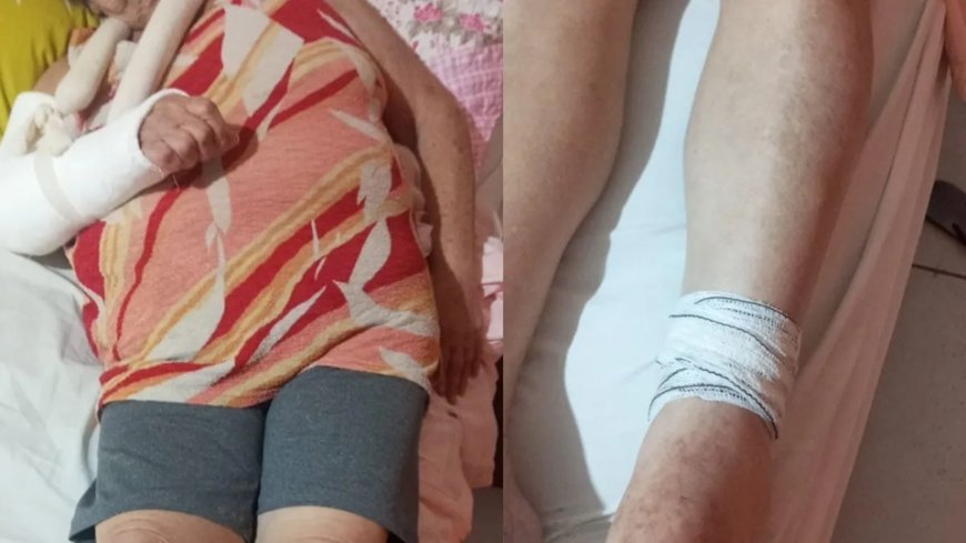 Idosa de 77 anos é agredida com cabo de vassoura em condomínio no RJ