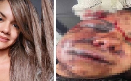 Homem que espancou namorada com 60 socos vai para cadeia pública