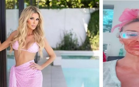 Ex-modelo tenta matar parasita no rosto e sofre graves consequências; vídeo