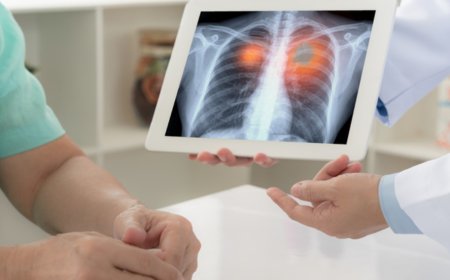Câncer de pulmão: saiba sobre os sintomas, diagnóstico e tratamento