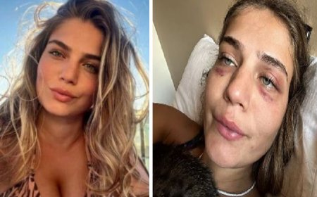 Modelo relembra agressões de jogador: ‘me agredia e abusava sexualmente’