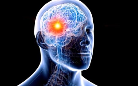 Tumor cerebral: veja 4 sinais que o corpo dá e você não deve ignorar