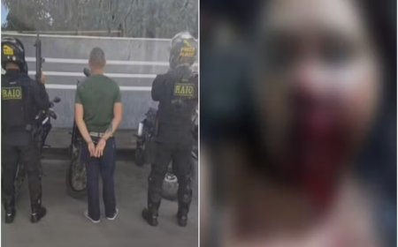 Homem é preso após desfigurar rosto da companheira com socos e facadas