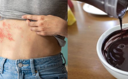 Açaí pode causar doença de Chagas? Entenda polêmica da COP30