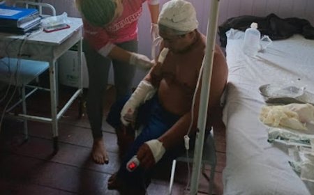 Cacique sobrevive a ataque de onça em comunidade indígena no Amazonas