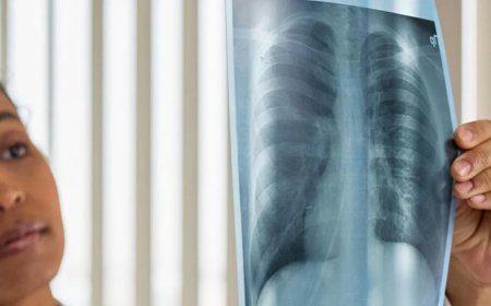 Câncer de pulmão: novo tratamento aumenta tempo de vida de pacientes